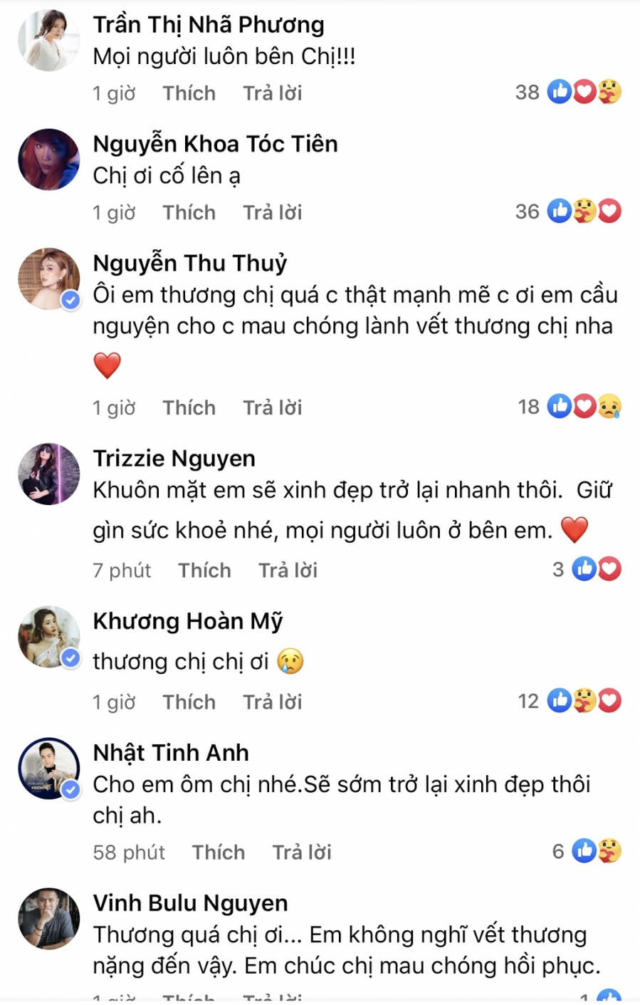 ca-si-hong-ngoc-chia-se-can-canh-guong-mat-bi-bong-nghiem-trong-khien-nhieu-nghe-si-xot-xa-cff-4955497