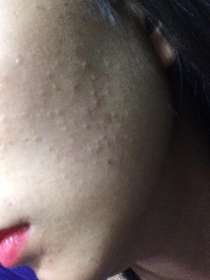 mun_an