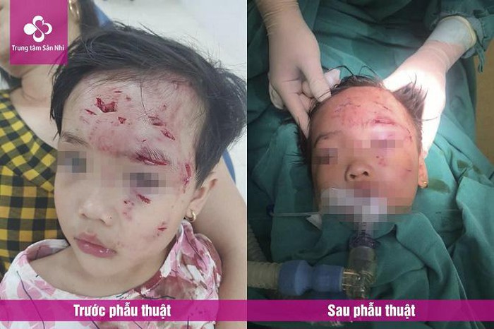 Hiện sức khỏe của bé đã ổn định hơn và vẫn đang được theo dõi, chăm sóc tại bệnh viện (Ảnh: Báo Tổ Quốc)