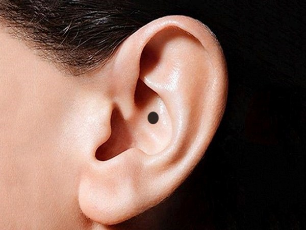 Nốt ruồi ở tai nói lên điều gì