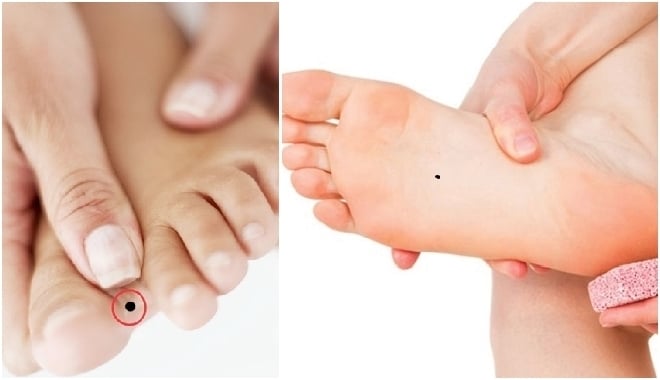 Nốt ruồi ở chân chứa cả mỏ vàng
