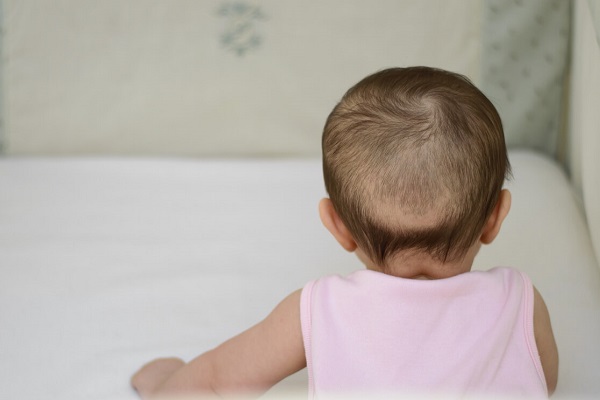 Trẻ bị rụng tóc vành khăn do thiếu chất.