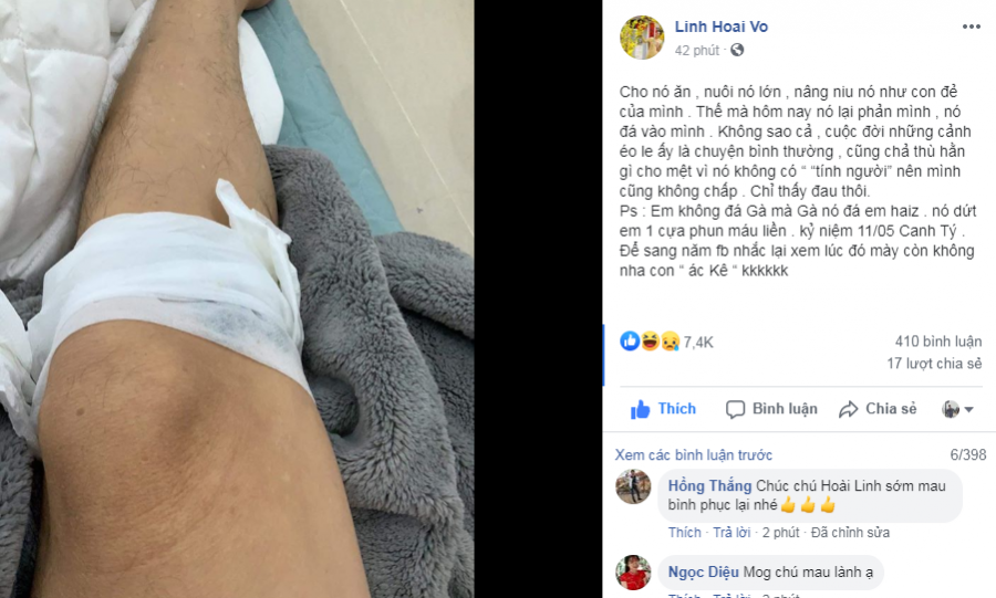 Trên trang cá nhân, danh hài Hoài Linh bất ngờ đăng tải hình ảnh chân bị thương phải nằm băng bó trong bệnh viện. Theo lời của Đệ nhất danh hài chia sẻ thì anh bị con gà đá, cựa của nó đâm vào chân khiến chân anh phụt nhiều máu phải băng bó lại. Sau khi bài viết được chia sẻ, rất nhiều khán giả và sao Việt bày tỏ lo lắng, hy vọng Hoài Linh sẽ sớm bình phục. Tuy nhiên, nam danh hài vẫn thể hiện sự yêu đời, không quên trấn an mọi người yên tâm vì anh không sao.