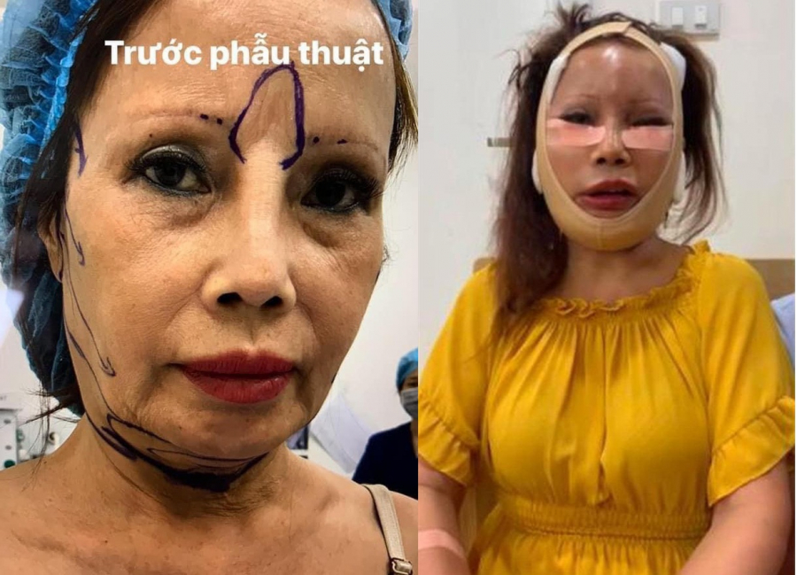 Cô dâu Thu Sao trước và sau khi 