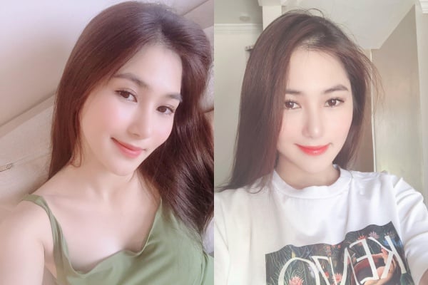 huong-tram-dep-len-boi-phan-nho-chiec-mui-thanh-thoat-va-thanh-tu-sau-phau-thuat-18-1593827187-78-width600height400