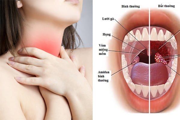 Dấu hiệu sau khi uống nước chứng tỏ bạn cần đi khám