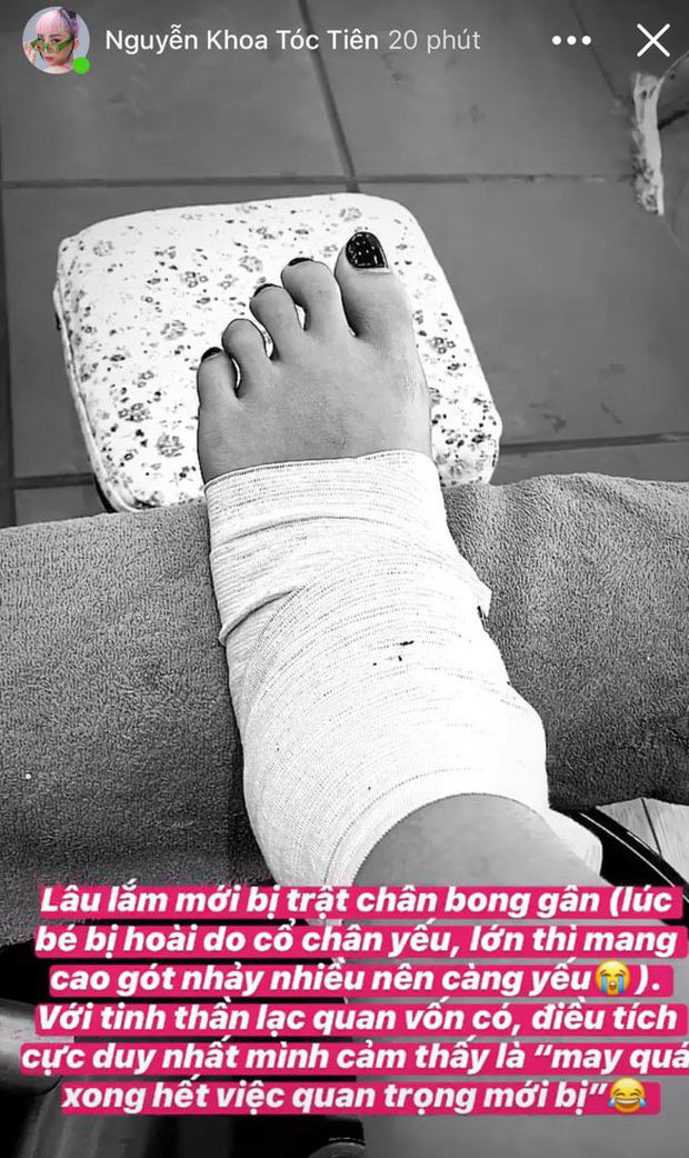 Mới đây, trên trang cá nhân, Tóc Tiên bất ngờ đăng tải hình ảnh bàn chân bị bong gân phải bó bột khiến fan vô cùng lo lắng. Dẫu chấn thương có làm ảnh hưởng không nhỏ đến sức khoẻ cũng như công việc của nữ ca sĩ trong thời gian tới thì cô vẫn giữ tinh thần lạc quan. Thậm chí, bà xã Hoàng Touliver còn cảm thấy “may” vì đã hoàn thành xong hết những công việc quan trọng. Rất nhiều đồng nghiệp và bạn bè của Tóc Tiên đã gửi lời động viên đến cô.