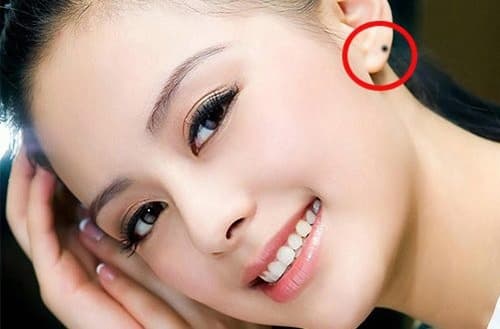 Nốt ruồi ở tai mang lại may mắn