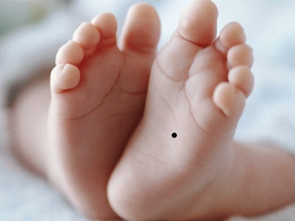 Nốt ruồi lòng bàn chân mang lại nhiều may mắn