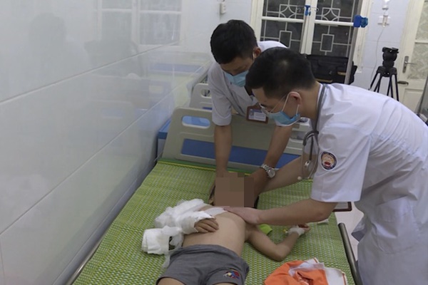 Bé gái bị bố bạo hành có nhiều vết bầm tím, trong đó tập trung nhiều ở vùng lưng cánh tay phải gãy 1/3 giữa xương.    