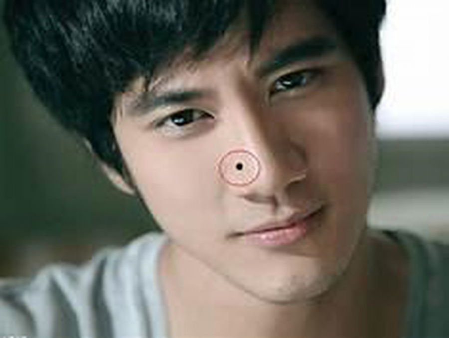 Nốt ruồi hút tài lộc