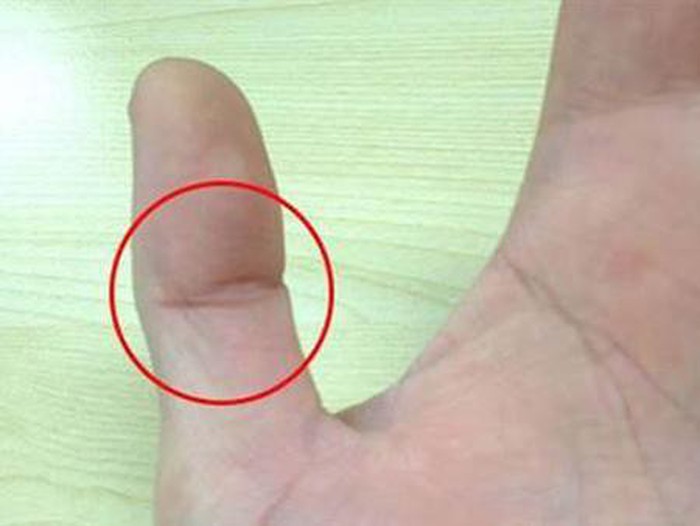 Bàn tay cái có vân mắt phượng