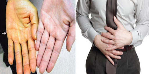 Đau bụng mệt mỏi cần đi khám