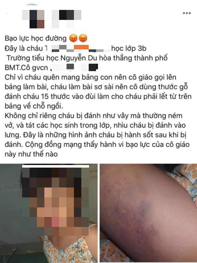 Không chấp nhận lời xin lỗi từ giáo viên, Shbet111 slot, casino, thể thao, xổ số đã đăng tải bức ảnh con mình bị đánh lên mạng xã hội
