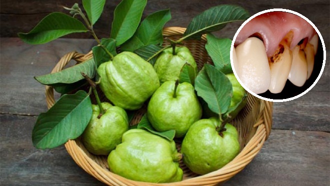 Việc ăn ổi sai cách chính là nguyên nhân khiến hàm răng của người phụ nữ bị hỏng nặng.