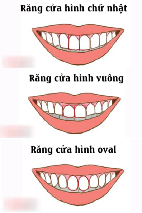 xem-tuong-rang-cua-02