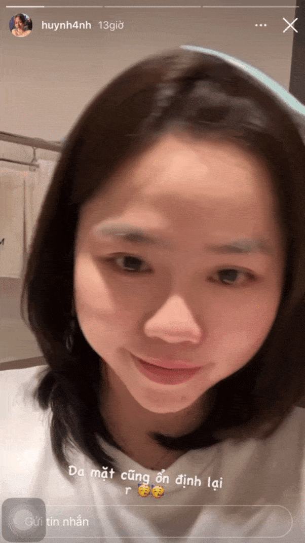 huynh-anh-cham-soc-da 6