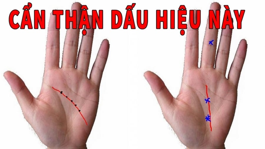 Bàn tay có nhiều gân xanh chạy dài vất vả