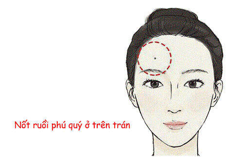 Nốt ruồi ở vùng trán mang lại nhiều may mắn