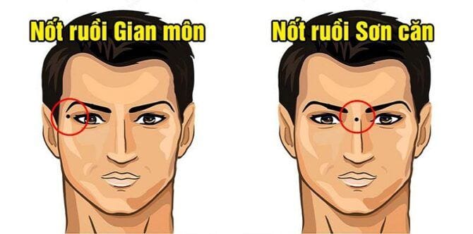 Sở hữu nốt ruồi này vô cùng may mắn