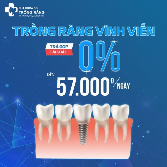 trong-rang-vinh-vien