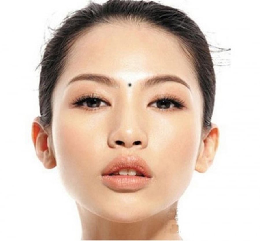 Nốt ruồi ở Ấn đường tán lộc