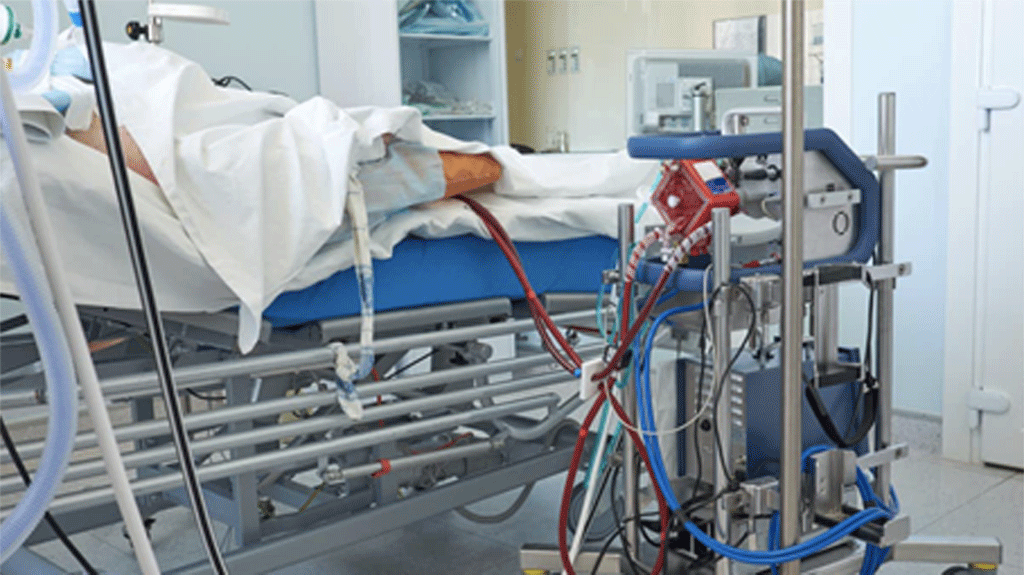 Có 2 bệnh nhân Covid-19 đang nguy kịch, phải can thiệp ECMO