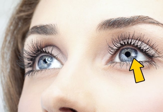 Mắt bị hoa và có đau nhức cần đi khám ngay