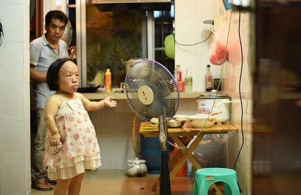 Chị Vi Xuân Lan và người chồng gù. (Ảnh: Sohu)    