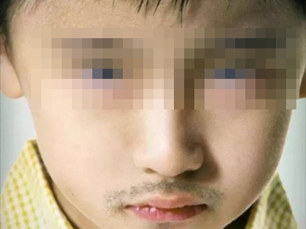 Trẻ dậy thì sớm thường cao lớn nhanh xuất hiện nhiều sự khác biệt trên Sh88bet đăng ký miễn phí