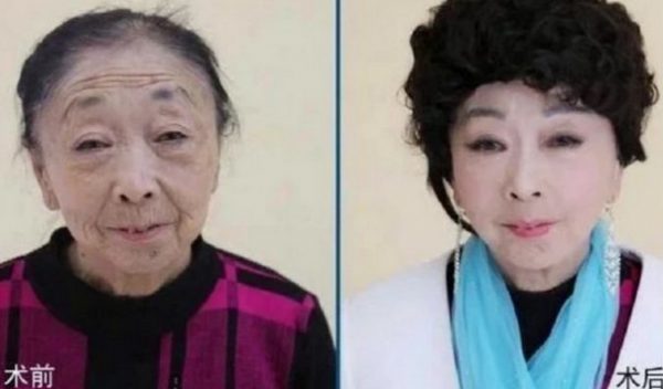 Bà Ma quyết định Shbet888 tiền thưởng cực khủng thẩm mỹ để giữ chồng (Ảnh: Kknews)