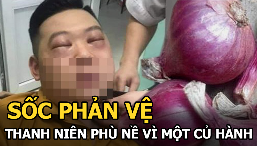 nam-thanh-nien-bi-soc-phan-ve-phu-ne-toan-mat-hai-mat-khong-the-mo-sau-khi-thai-mot-cu-hanh-080-5720777