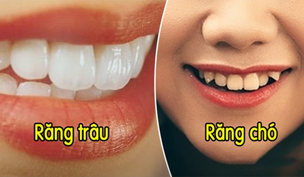 xem-tuong-rang-01