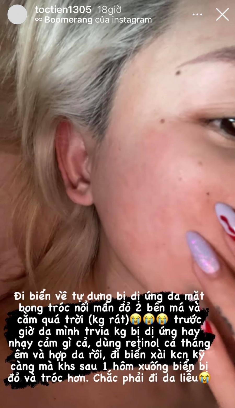 toctien 1
