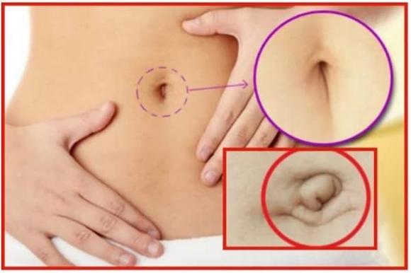 Nhìn tướng rốn biết ngay làm quan hay làm lính
