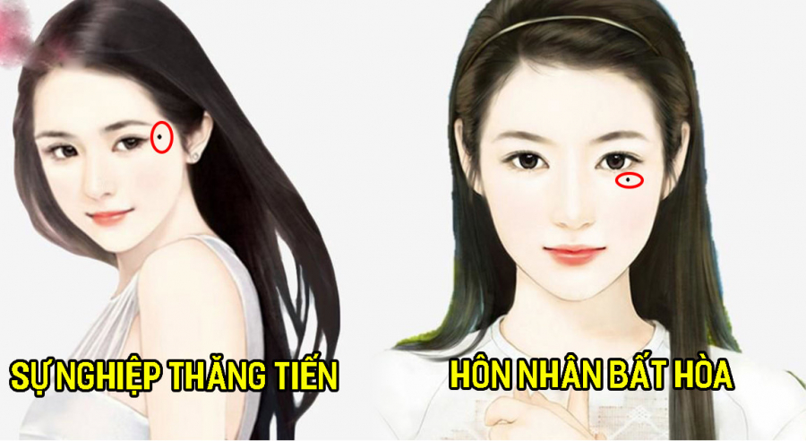 Những nốt ruồi mang lại tài lộc cho chủ nhân của mình
