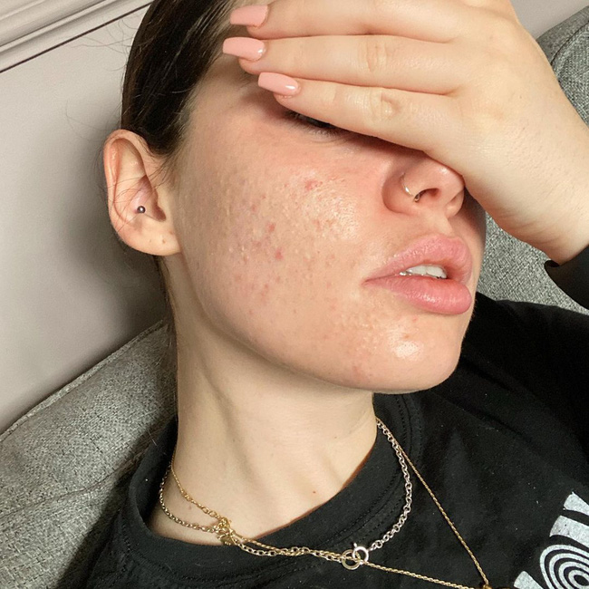 annhieuduong 2