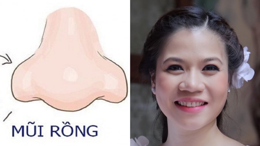 Tướng mũi lân (mũi rồng)