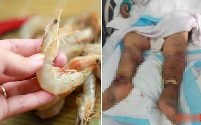 Một người đàn ông 60 tuổi ở Hàng Châu, Trung Quốc bị 