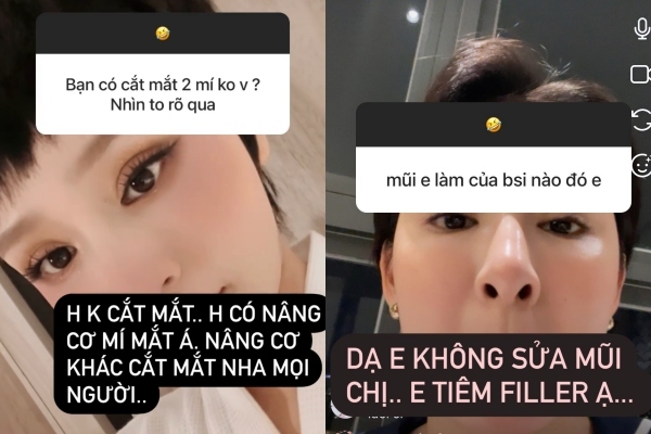 hien-ho-phu-nhan-on-ao-phau-thuat-mui-nho-cay-filler-nang-co-mi-mat-a59c7531