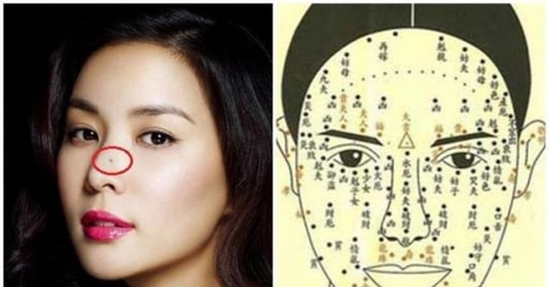 Nốt ruồi chóp mũi không tốt cho tình duyên
