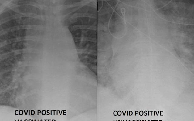 tiem-vaccine-covid-1628077585383232725498-0-0-399-639-crop-16280775896271557610048