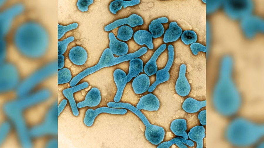 virus-marburg-02