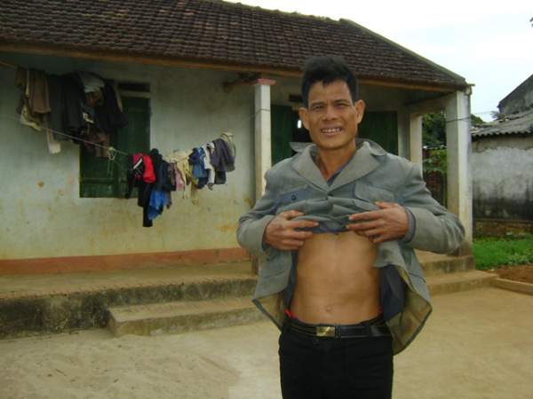 Chiếc bụng 
