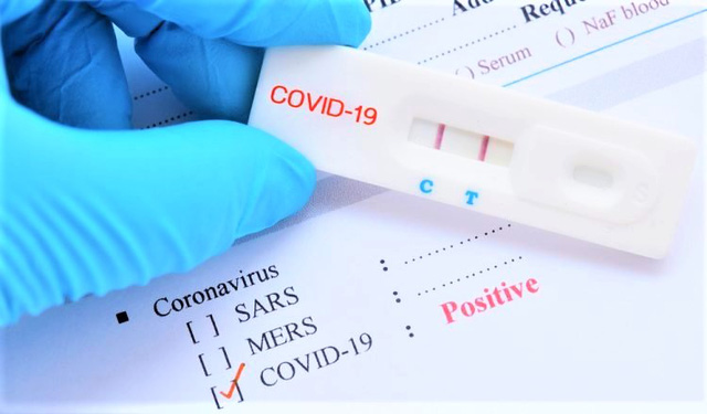 test-nhanh-duong-tinh-xet-nghiem-pcr-am-tinh-bs-giai-thich-01