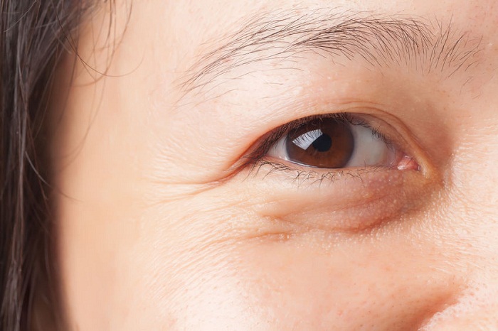 Đuôi mắt thể hiện rõ nhất tuổi bạn của bạn