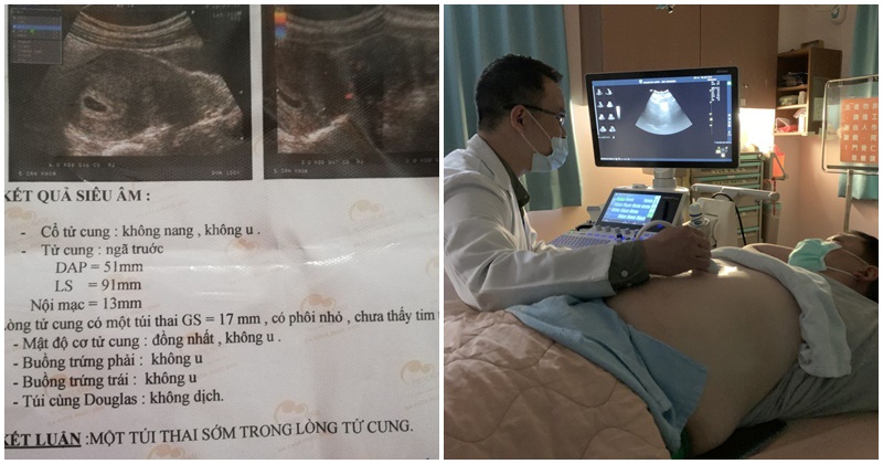 Người đàn ông đi siêu âm nhận tin mang thai 