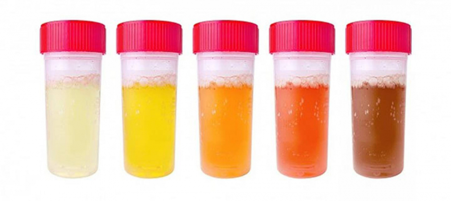doan-benh-nam-gioi-thong-qua-mau-nuoc-tieu-01-1578359488021750461357