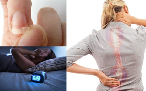 Dấu hiệu Sh88bet đăng ký miễn phí bạn bị thiếu canxi