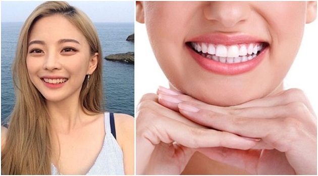 Tướng răng nói lên mức độ giàu nghèo của phụ nữ